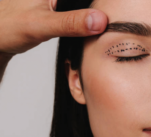 Experienced Surgeons Providing Blepharoplasty Consultations in Essex